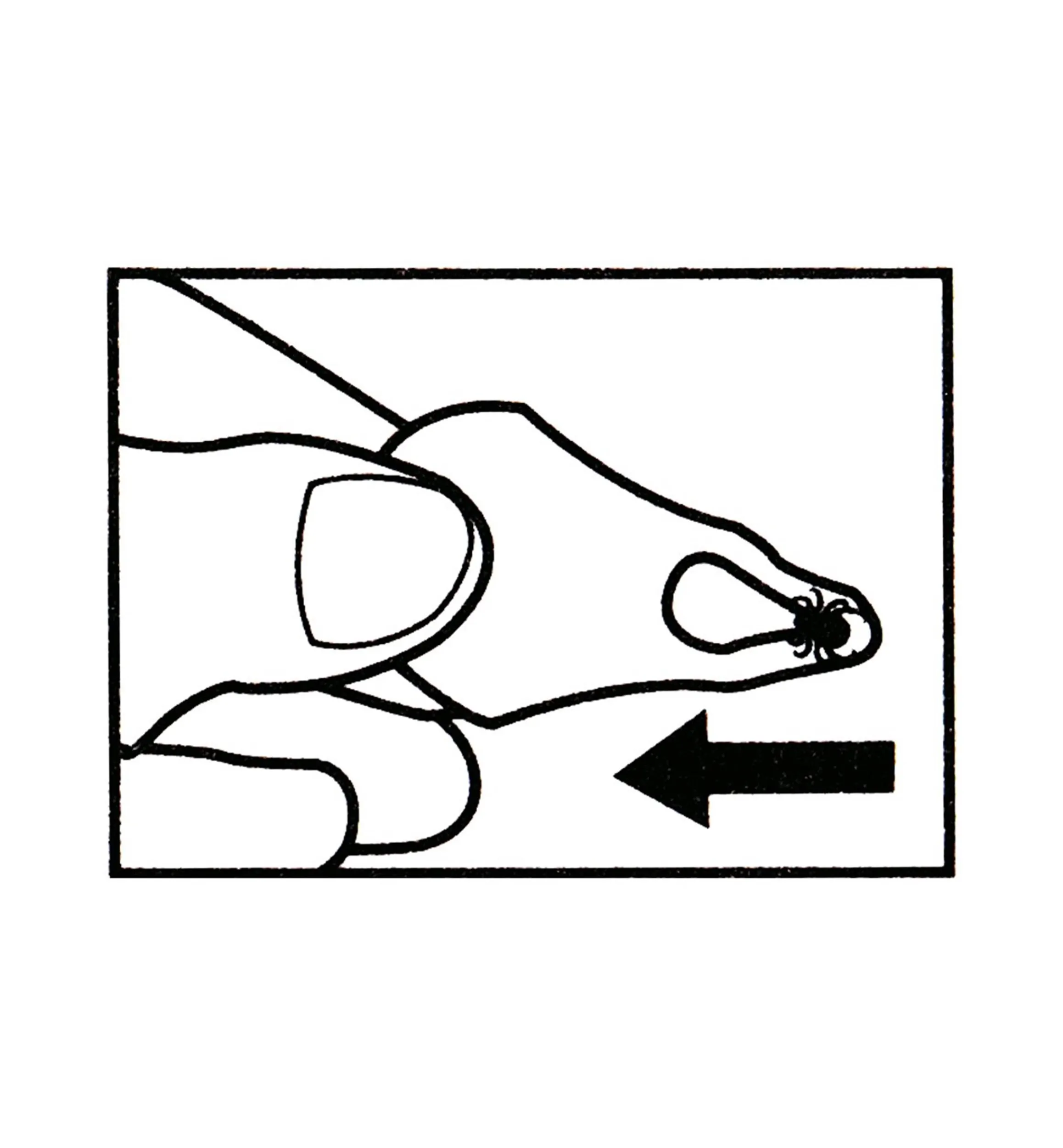 Lee Valley Pest Control>Tick Key Tick Remover